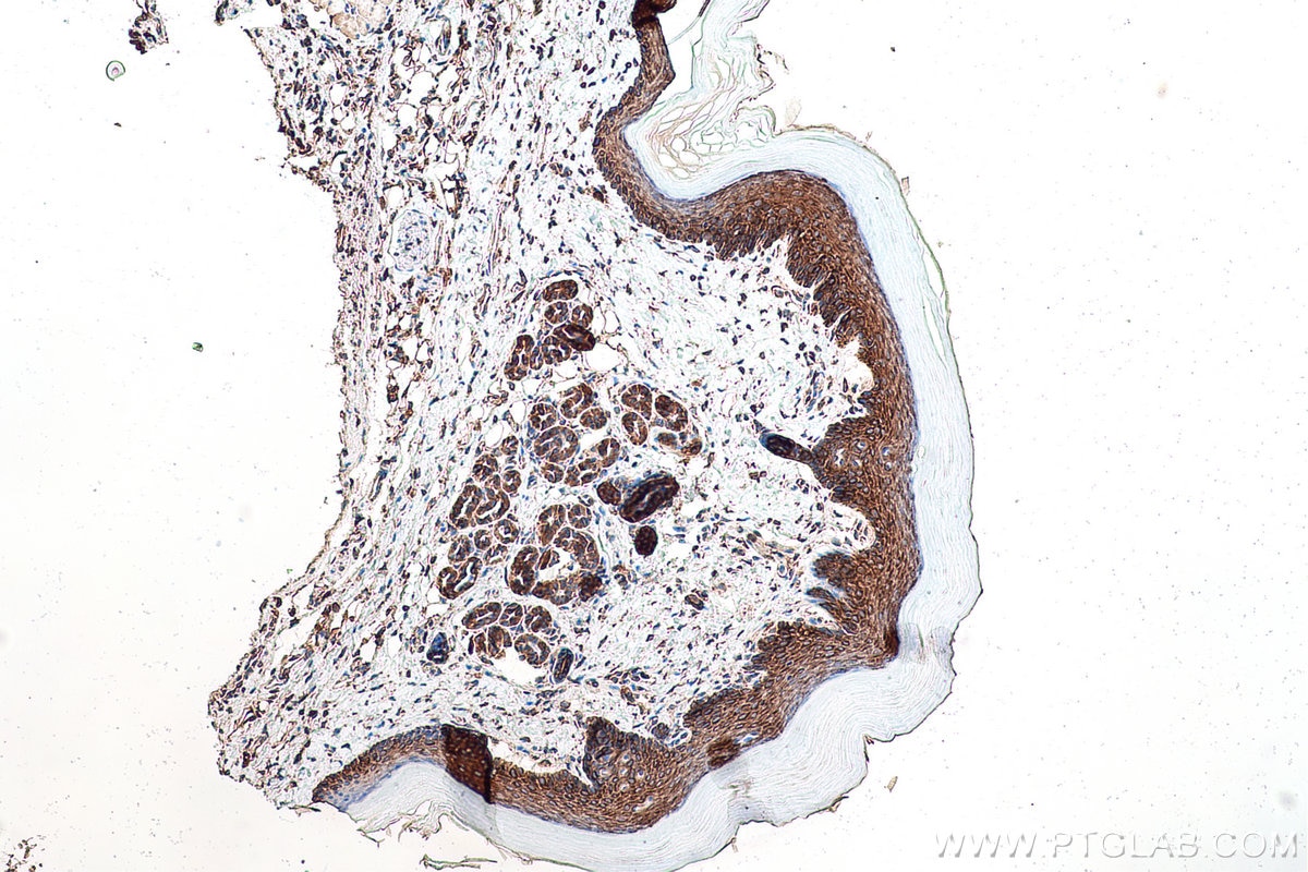 Immunohistochemical analysis of paraffin-embedded mouse skin tissue slide using KHC0831 (RPLP1 IHC Kit).