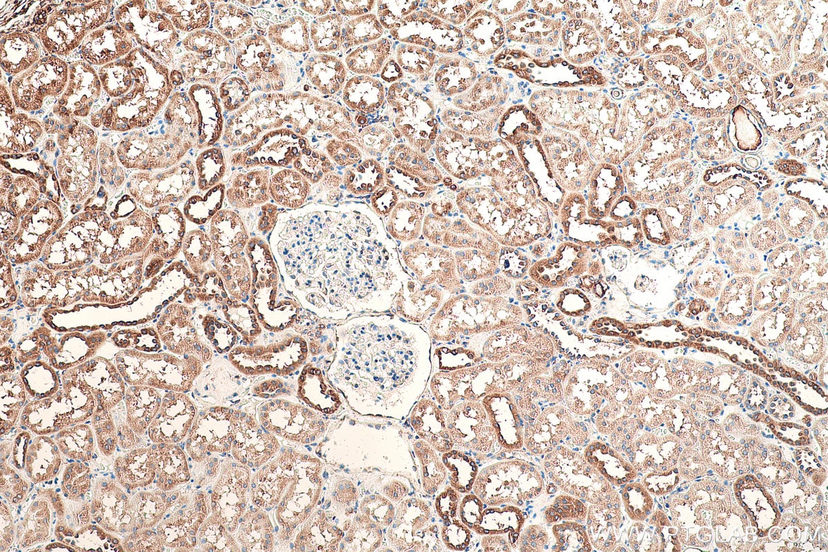 Immunohistochemical analysis of paraffin-embedded human kidney tissue slide using KHC0831 (RPLP1 IHC Kit).