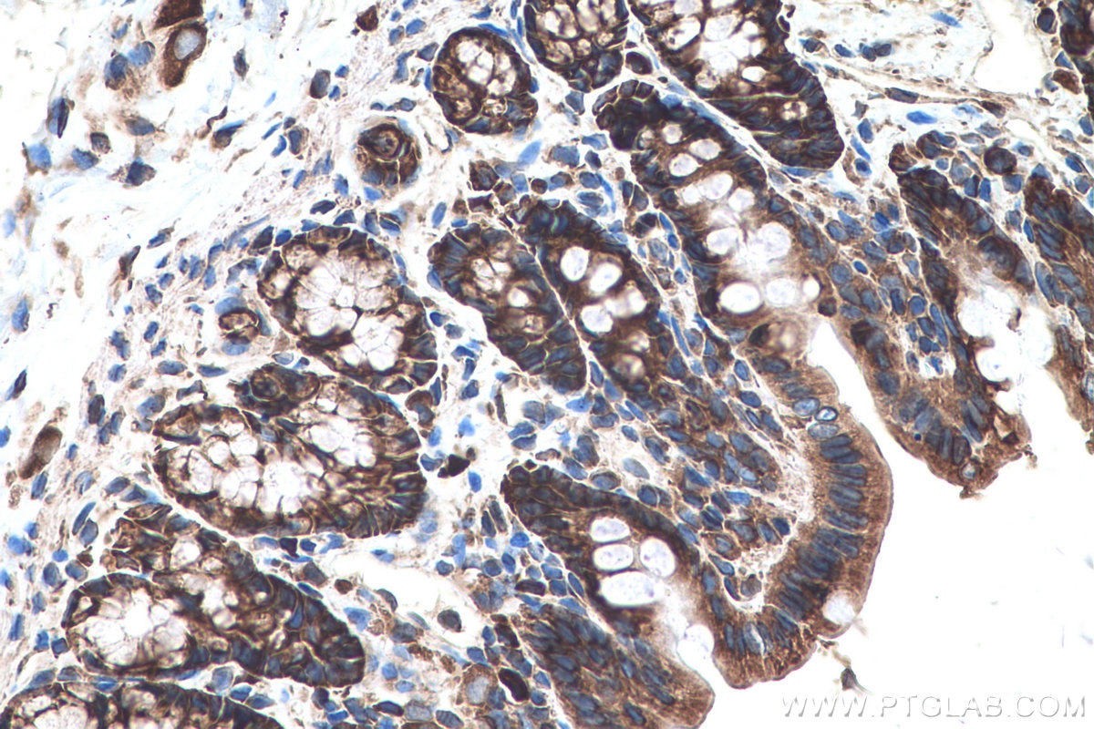 Immunohistochemical analysis of paraffin-embedded rat colon tissue slide using KHC0576 (RPLP2 IHC Kit).