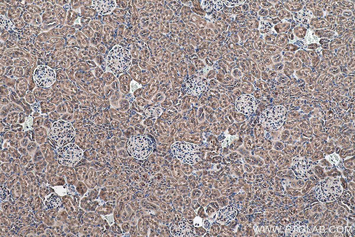 Immunohistochemical analysis of paraffin-embedded rat kidney tissue slide using KHC0576 (RPLP2 IHC Kit).