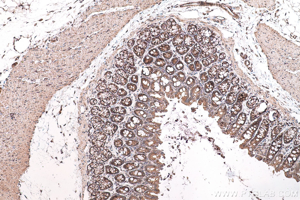 Immunohistochemical analysis of paraffin-embedded rat colon tissue slide using KHC0711 (RPN2 IHC Kit).