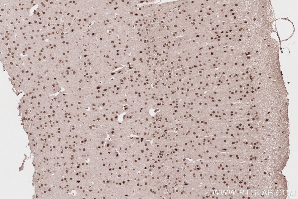 Immunohistochemical analysis of paraffin-embedded mouse brain tissue slide using KHC2812 (RPRD1A/P15RS IHC Kit).