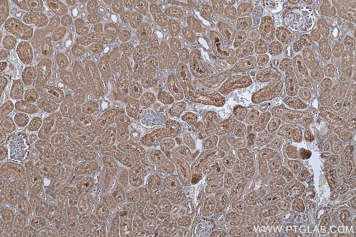 Immunohistochemical analysis of paraffin-embedded mouse kidney tissue slide using KHC0641 (RPS13 IHC Kit).