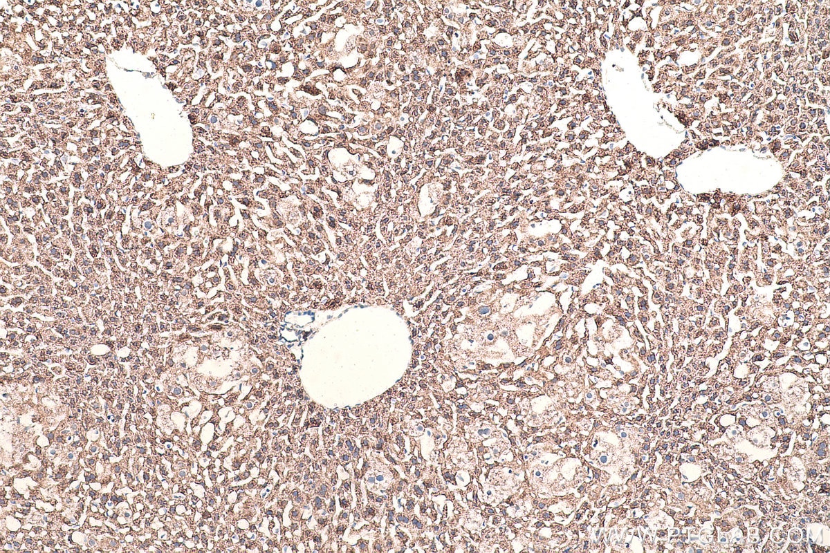 Immunohistochemical analysis of paraffin-embedded mouse liver tissue slide using KHC0930 (RPS15 IHC Kit).