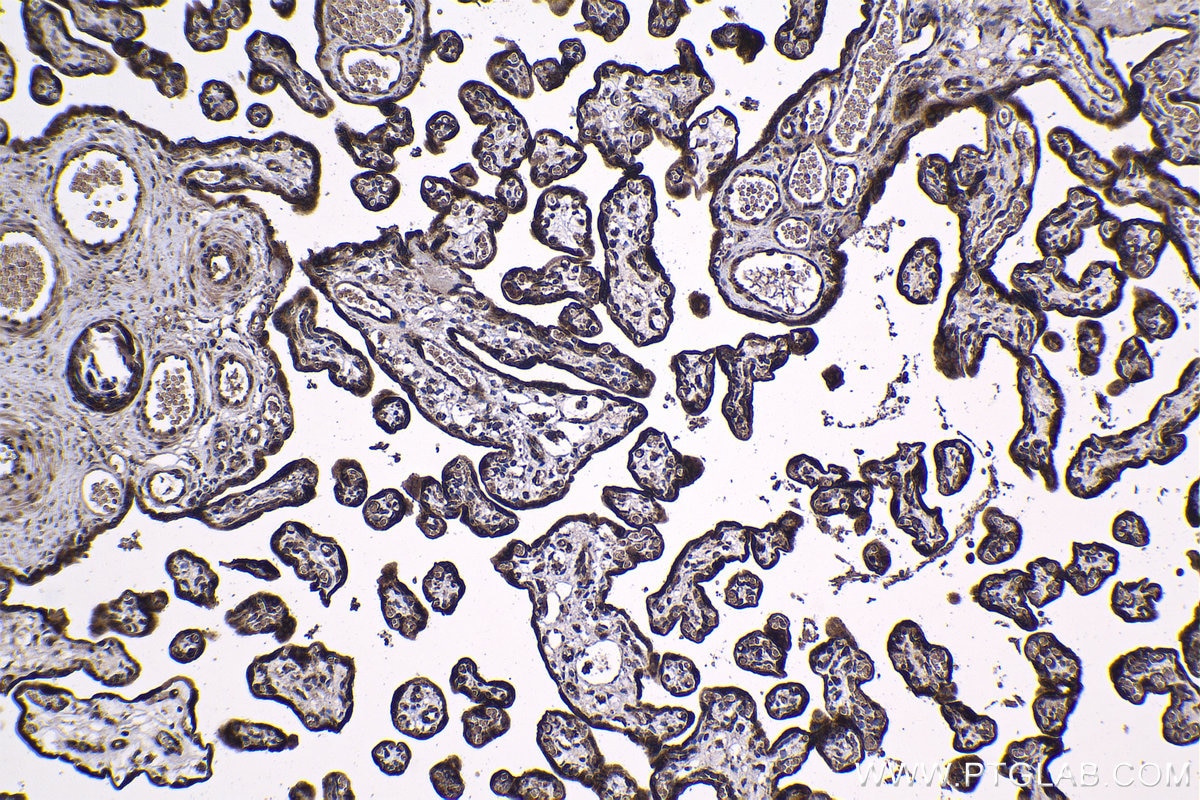 Immunohistochemical analysis of paraffin-embedded human placenta tissue slide using KHC1188 (RPS20 IHC Kit).