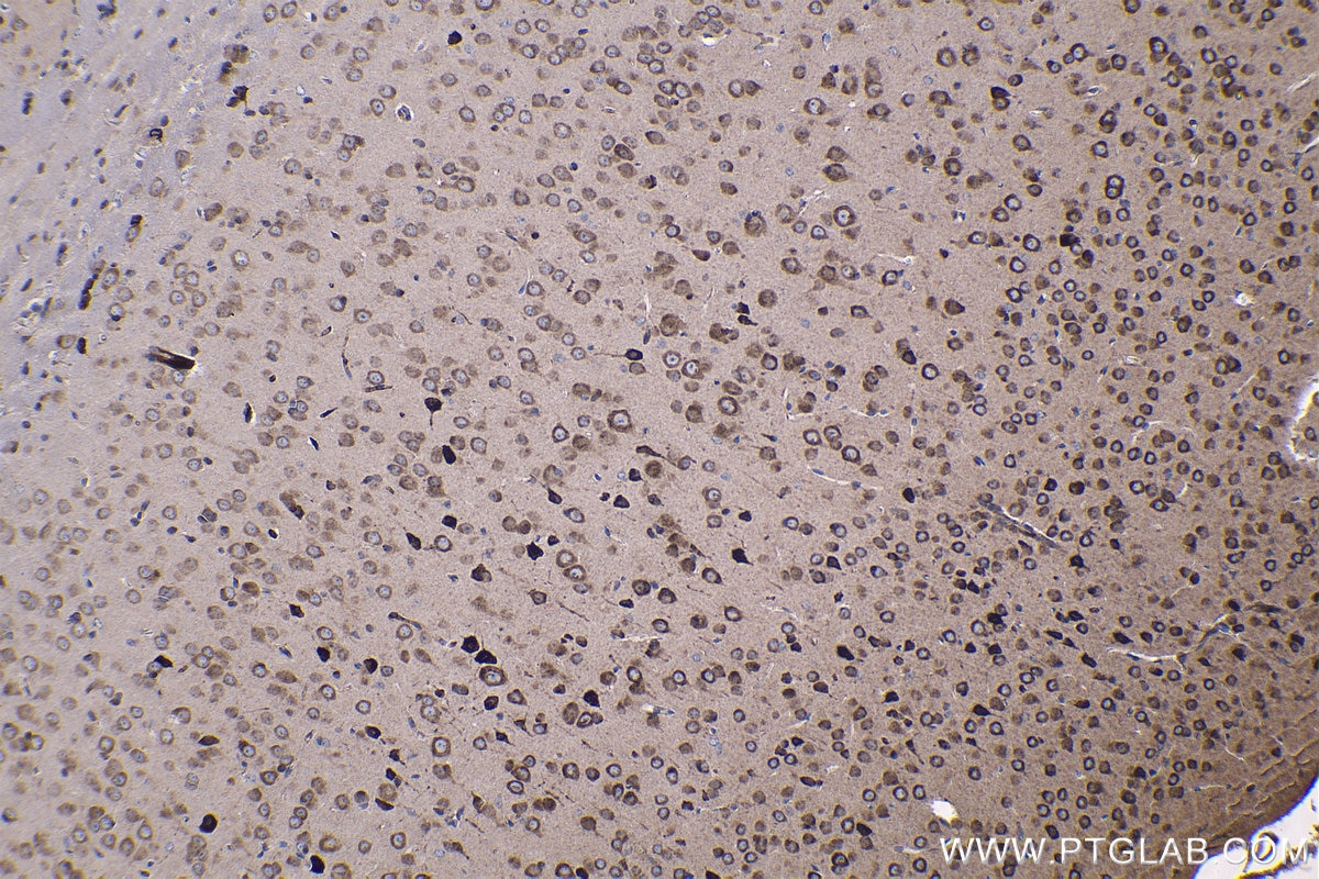 Immunohistochemical analysis of paraffin-embedded mouse brain tissue slide using KHC1188 (RPS20 IHC Kit).