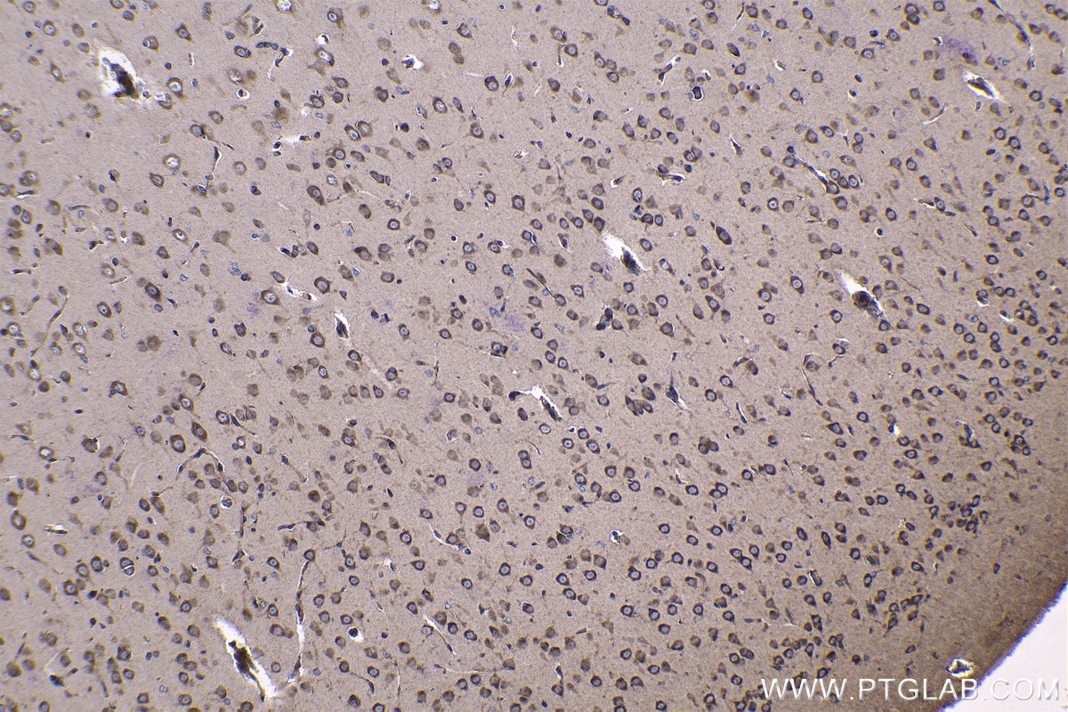 Immunohistochemical analysis of paraffin-embedded rat brain tissue slide using KHC1188 (RPS20 IHC Kit).