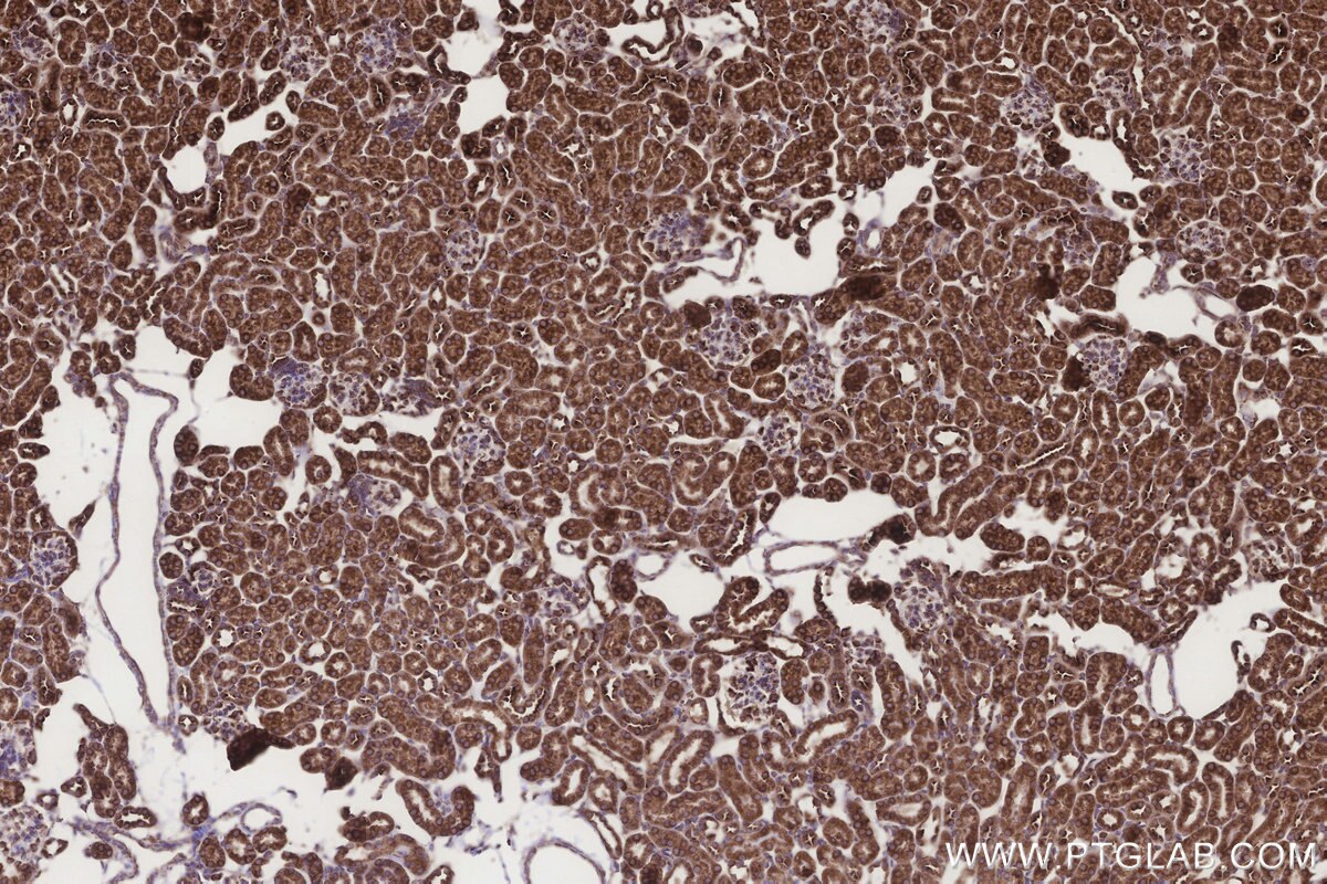 Immunohistochemical analysis of paraffin-embedded mouse kidney tissue slide using KHC3243 (RPS23 IHC Kit). Immunohistochemical analysis of paraffin-embedded mouse kidney tissue slide using KHC3243 (RPS23 IHC Kit).