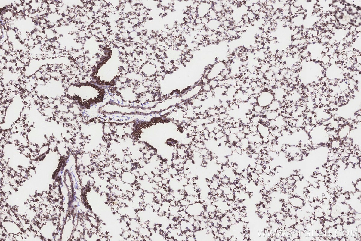 Immunohistochemical analysis of paraffin-embedded mouse lung tissue slide using KHC3243 (RPS23 IHC Kit). Immunohistochemical analysis of paraffin-embedded mouse lung tissue slide using KHC3243 (RPS23 IHC Kit).