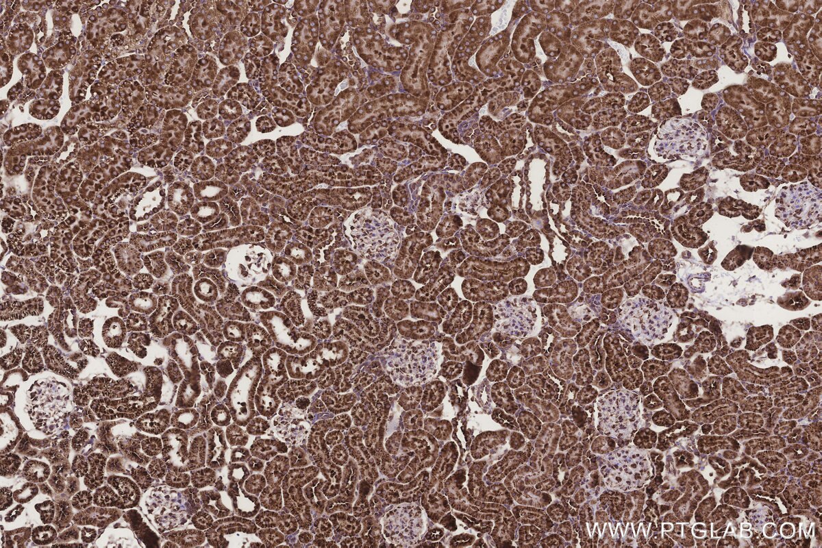 Immunohistochemical analysis of paraffin-embedded rat kidney tissue slide using KHC3243 (RPS23 IHC Kit). Immunohistochemical analysis of paraffin-embedded rat kidney tissue slide using KHC3243 (RPS23 IHC Kit).