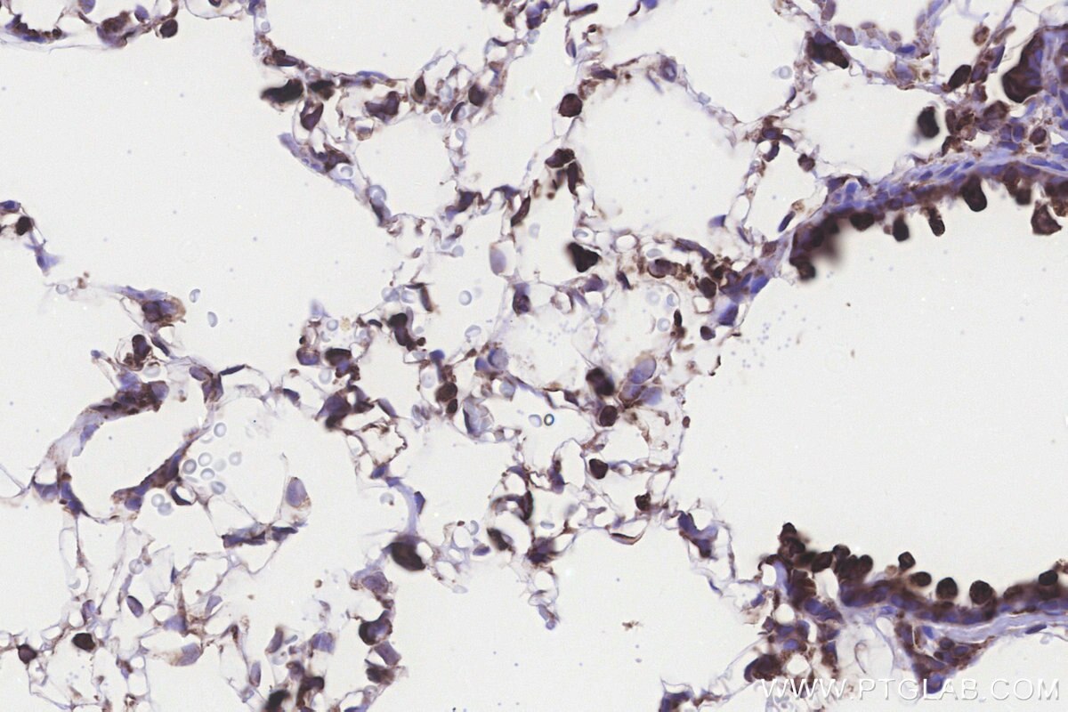 Immunohistochemical analysis of paraffin-embedded rat lung tissue slide using KHC3243 (RPS23 IHC Kit). Immunohistochemical analysis of paraffin-embedded rat lung tissue slide using KHC3243 (RPS23 IHC Kit).