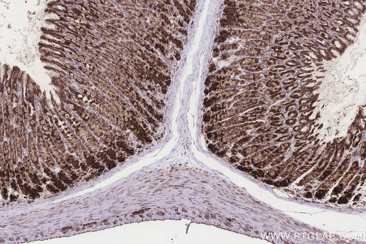 Immunohistochemical analysis of paraffin-embedded rat stomach tissue slide using KHC3243 (RPS23 IHC Kit). Immunohistochemical analysis of paraffin-embedded rat stomach tissue slide using KHC3243 (RPS23 IHC Kit).
