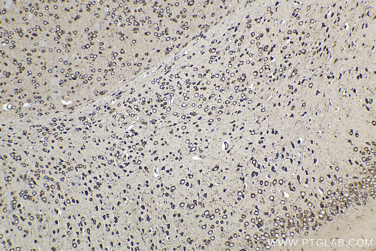 Immunohistochemical analysis of paraffin-embedded mouse brain tissue slide using KHC1560 (RPS3 IHC Kit).
