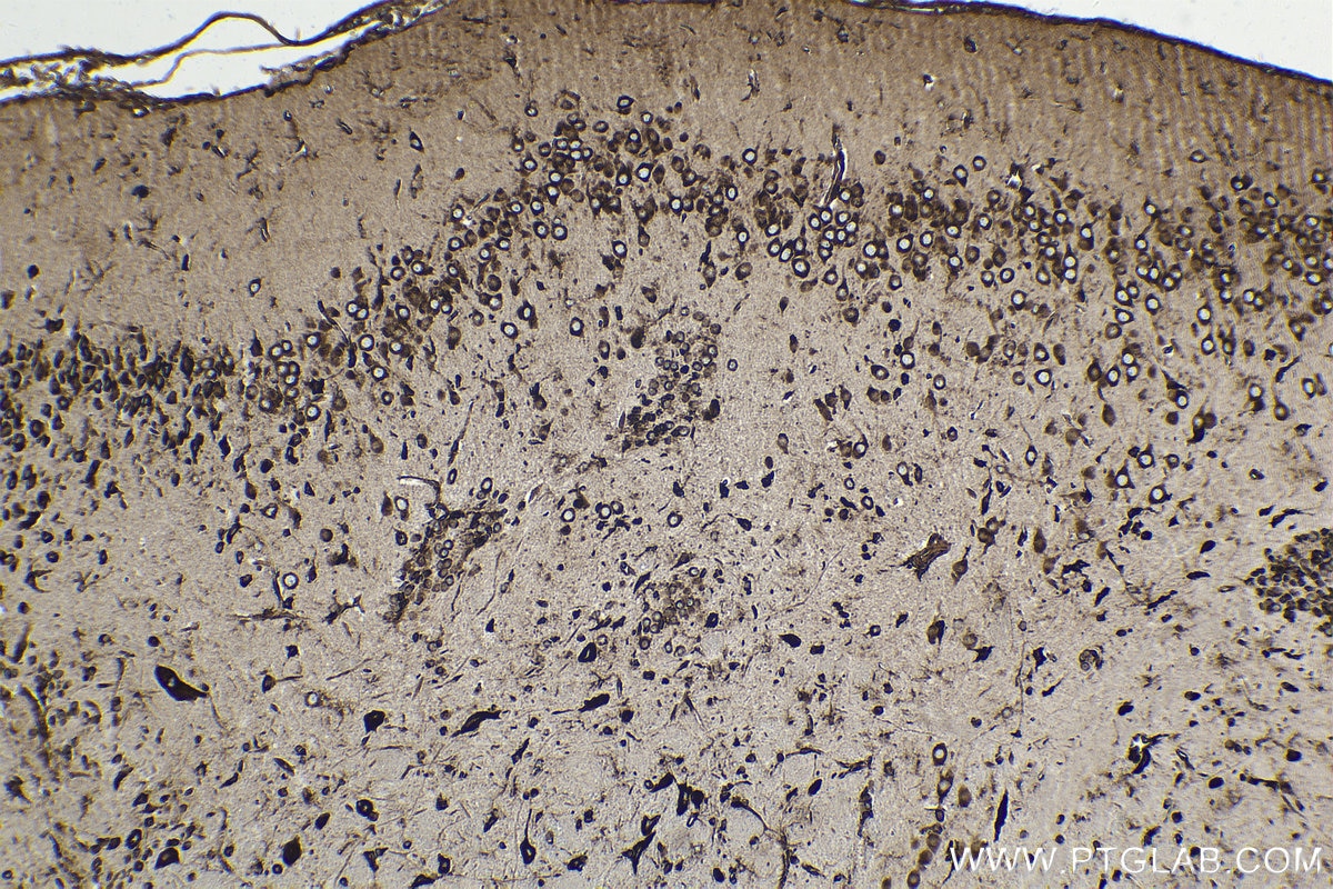 Immunohistochemical analysis of paraffin-embedded rat brain tissue slide using KHC1560 (RPS3 IHC Kit).