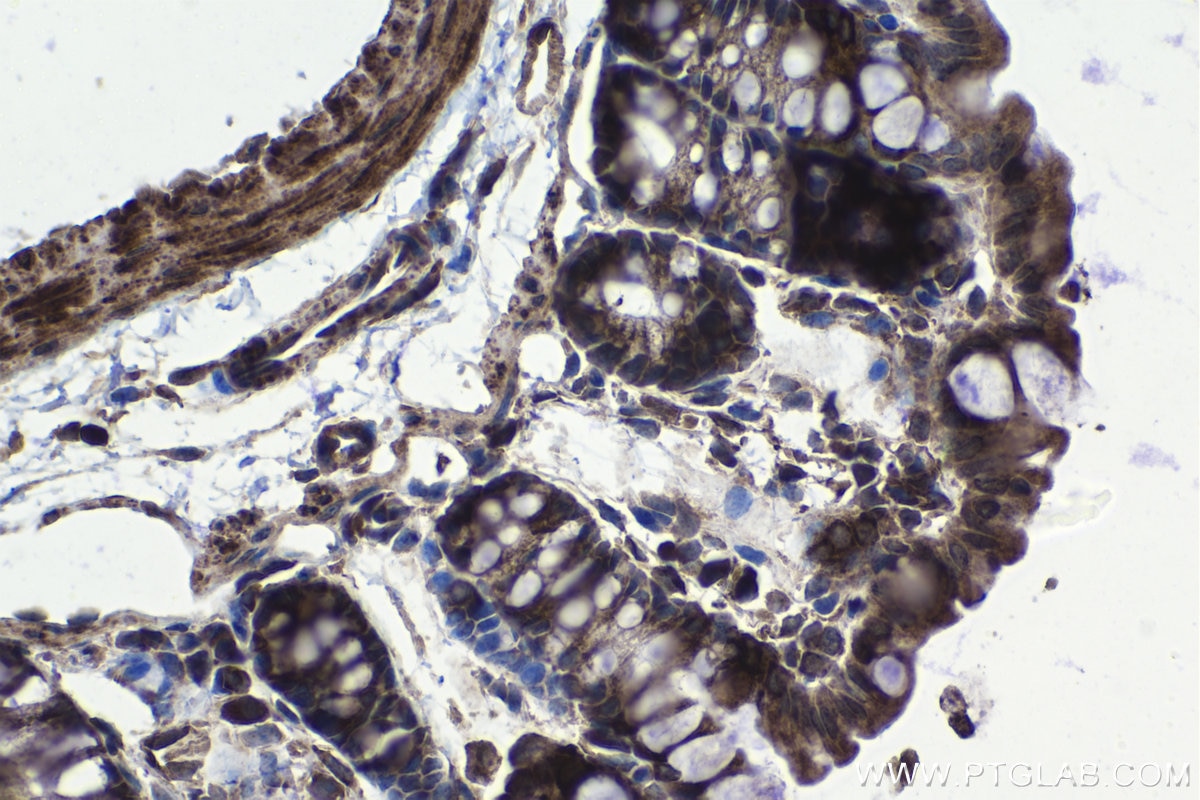 Immunohistochemical analysis of paraffin-embedded mouse colon tissue slide using KHC1146 (RPS5 IHC Kit).