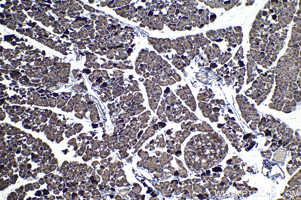 Immunohistochemical analysis of paraffin-embedded mouse pancreas tissue slide using KHC1146 (RPS5 IHC Kit).