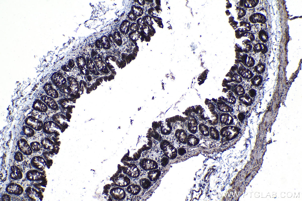 Immunohistochemical analysis of paraffin-embedded rat colon tissue slide using KHC1146 (RPS5 IHC Kit).