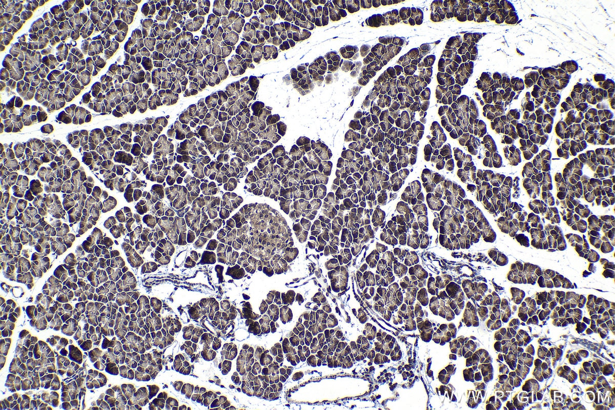 Immunohistochemical analysis of paraffin-embedded rat pancreas tissue slide using KHC1146 (RPS5 IHC Kit).