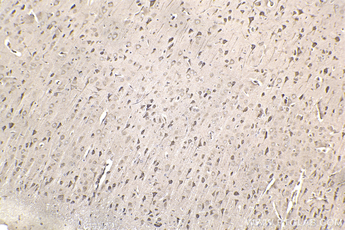 Immunohistochemical analysis of paraffin-embedded rat brain tissue slide using KHC2352 (RPS6 IHC Kit).