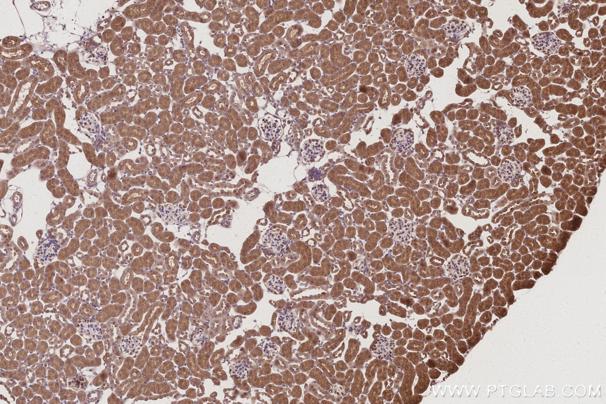 Immunohistochemical analysis of paraffin-embedded mouse kidney tissue slide using KHC3001 (RPS6KB2 IHC Kit). Immunohistochemical analysis of paraffin-embedded mouse kidney tissue slide using KHC3001 (RPS6KB2 IHC Kit).