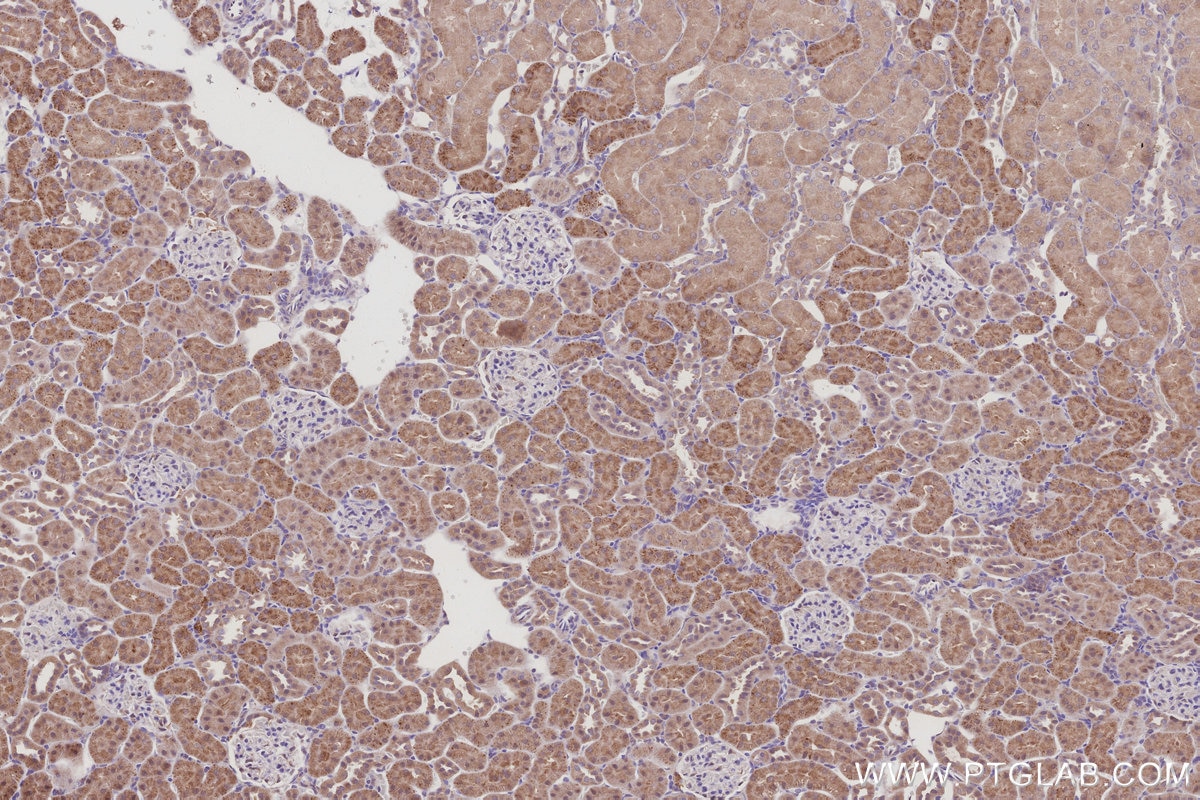Immunohistochemical analysis of paraffin-embedded rat kidney tissue slide using KHC3001 (RPS6KB2 IHC Kit). Immunohistochemical analysis of paraffin-embedded rat kidney tissue slide using KHC3001 (RPS6KB2 IHC Kit).