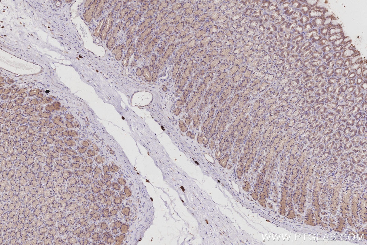 Immunohistochemical analysis of paraffin-embedded rat stomach tissue slide using KHC3001 (RPS6KB2 IHC Kit). Immunohistochemical analysis of paraffin-embedded rat stomach tissue slide using KHC3001 (RPS6KB2 IHC Kit).