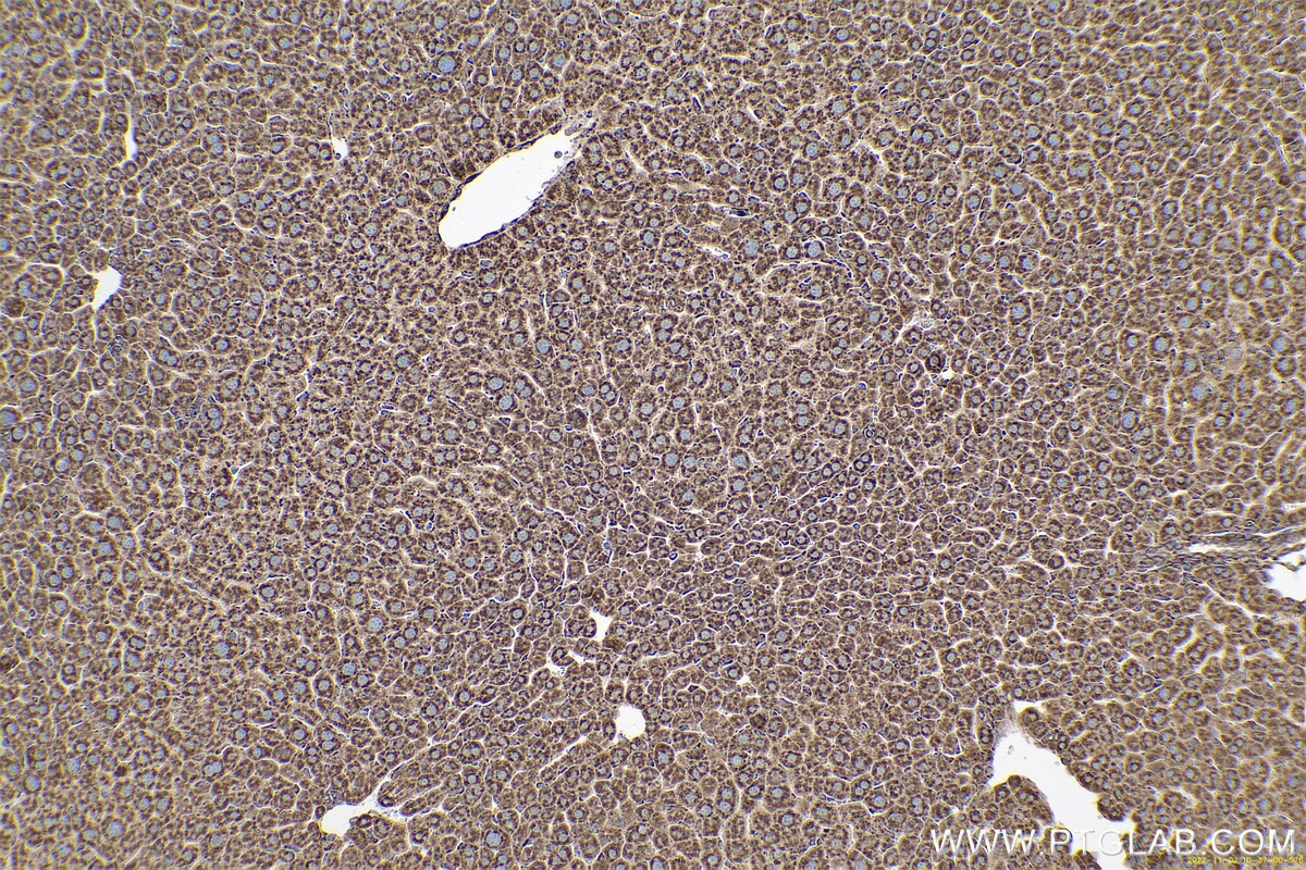 Immunohistochemical analysis of paraffin-embedded mouse liver tissue slide using KHC0662 (RRBP1 IHC Kit).