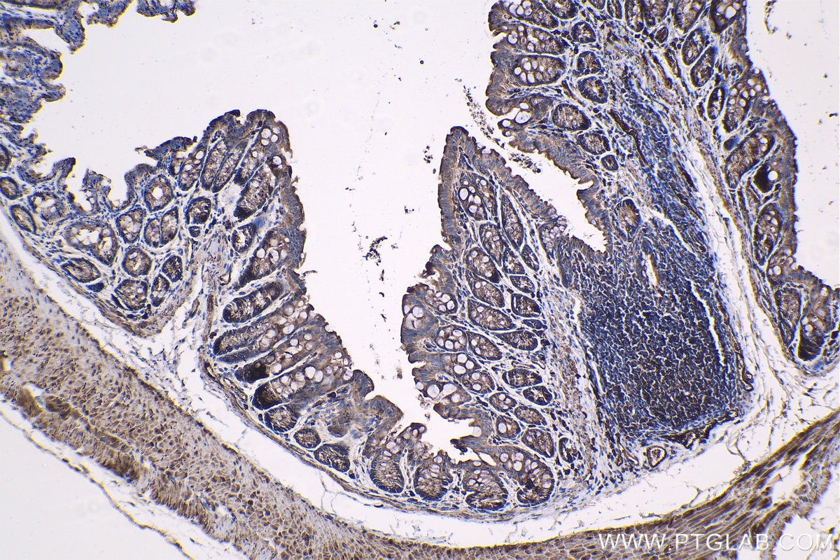 Immunohistochemical analysis of paraffin-embedded mouse colon tissue slide using KHC1330 (RRM1 IHC Kit).