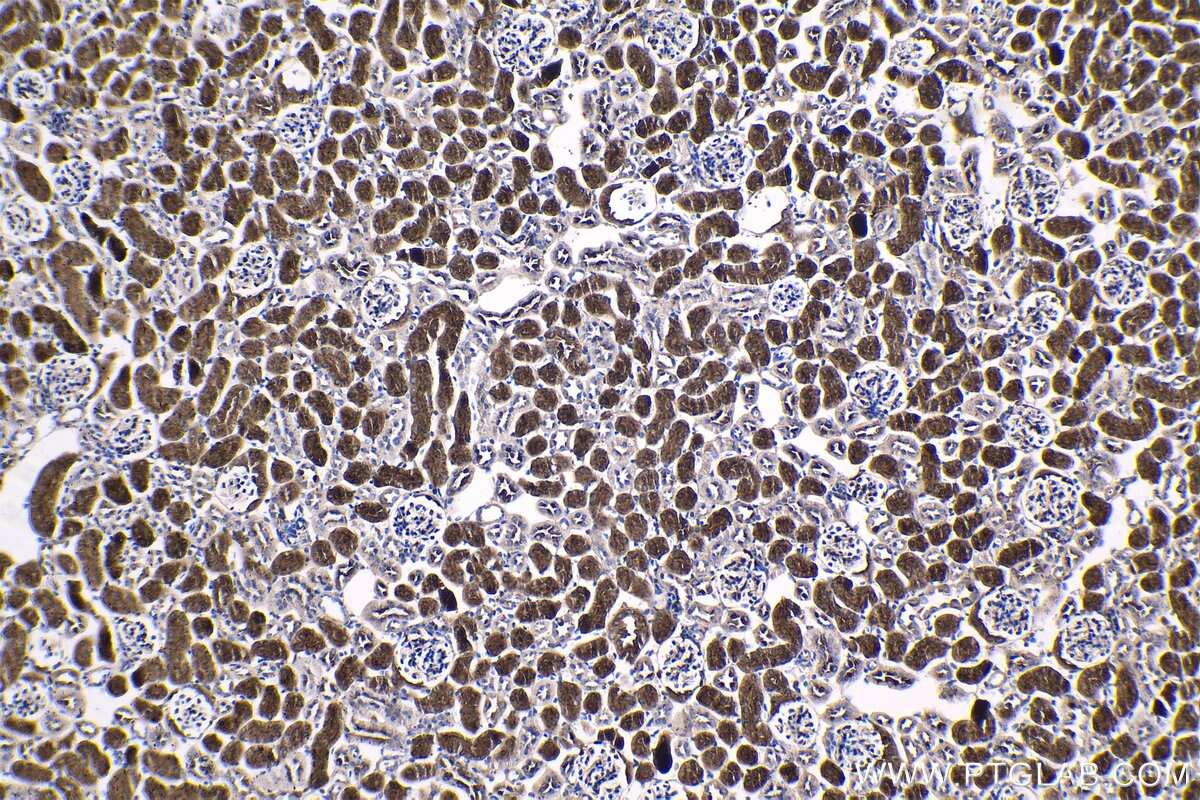 Immunohistochemical analysis of paraffin-embedded mouse kidney tissue slide using KHC1330 (RRM1 IHC Kit).