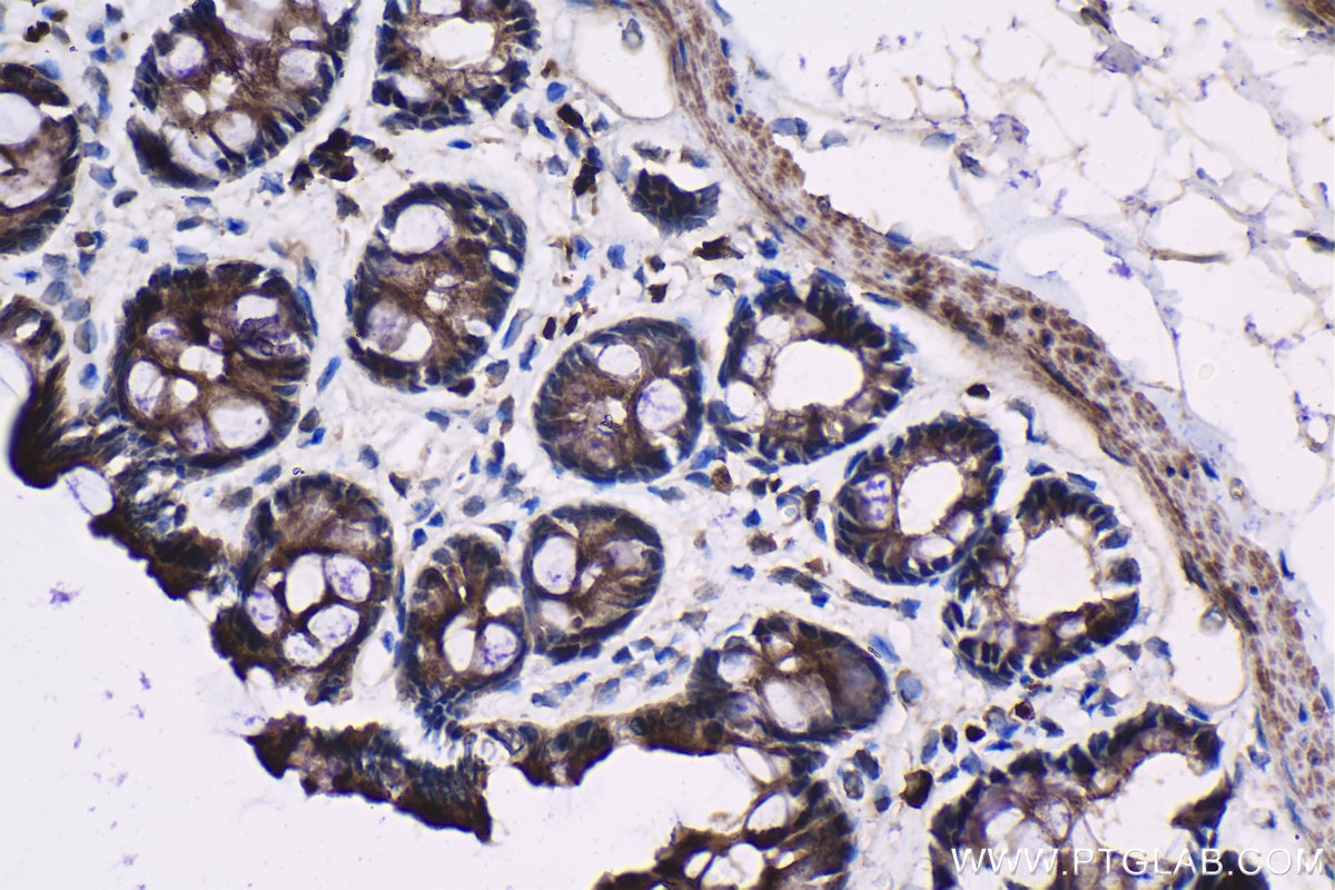 Immunohistochemical analysis of paraffin-embedded rat colon tissue slide using KHC1330 (RRM1 IHC Kit).