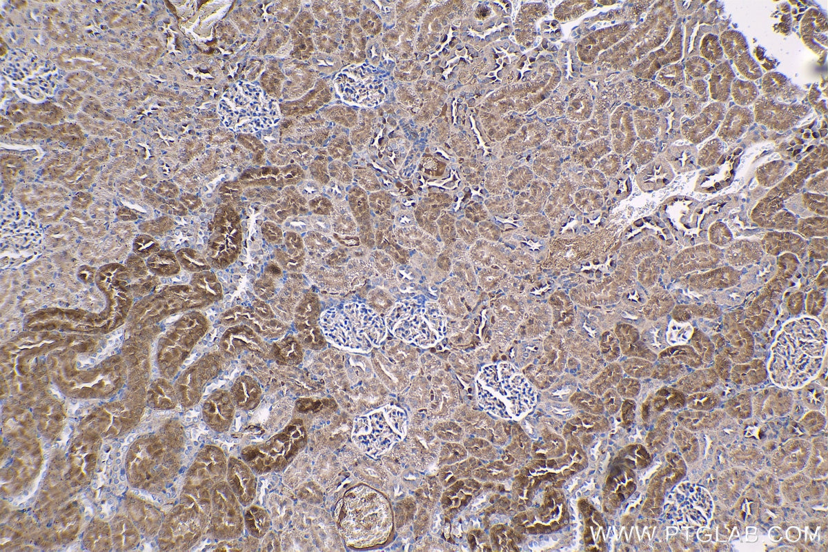 Immunohistochemical analysis of paraffin-embedded rat kidney tissue slide using KHC1330 (RRM1 IHC Kit).