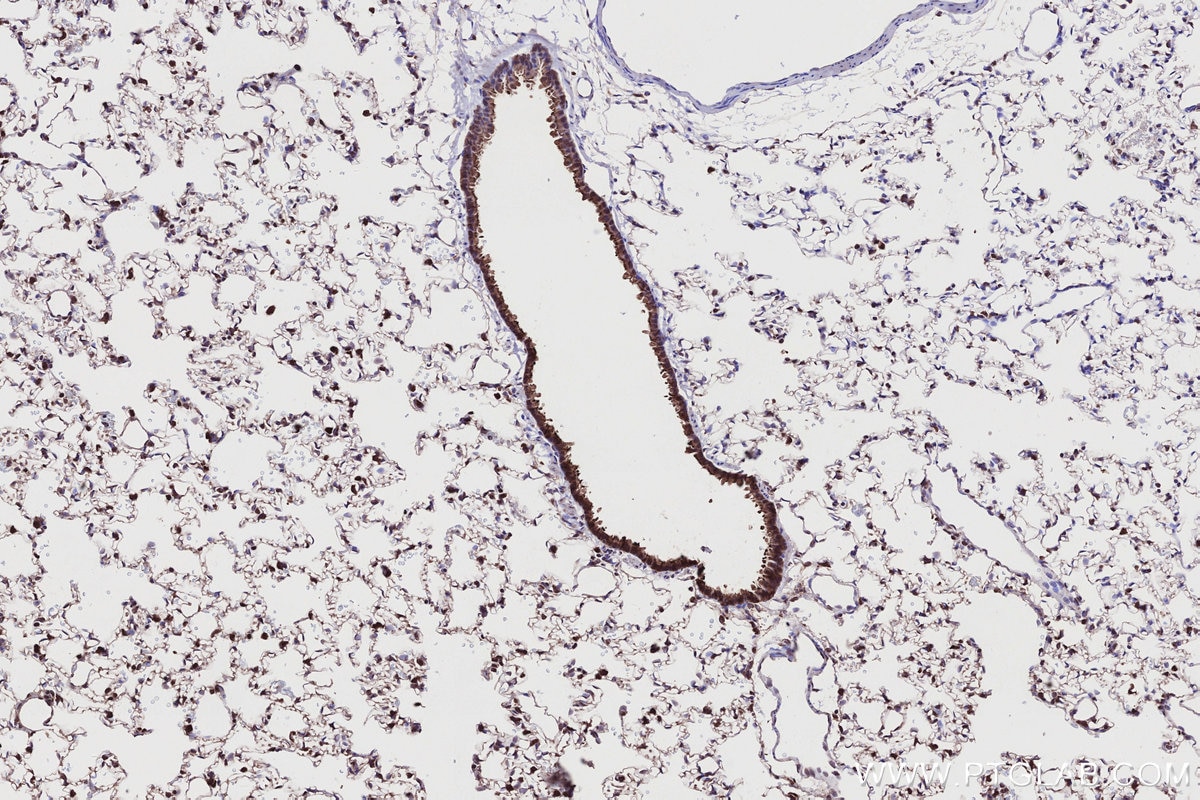 Immunohistochemical analysis of paraffin-embedded rat lung tissue slide using KHC2745 (RSPH1 IHC Kit).
