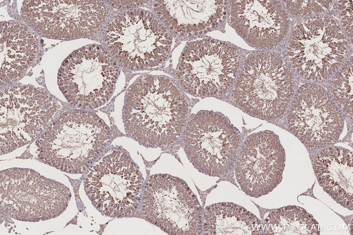 Immunohistochemical analysis of paraffin-embedded rat testis tissue slide using KHC2745 (RSPH1 IHC Kit).
