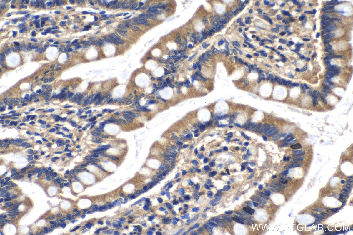 Immunohistochemical analysis of paraffin-embedded human small intestine tissue slide using KHC0225 (RSPO1 IHC Kit).