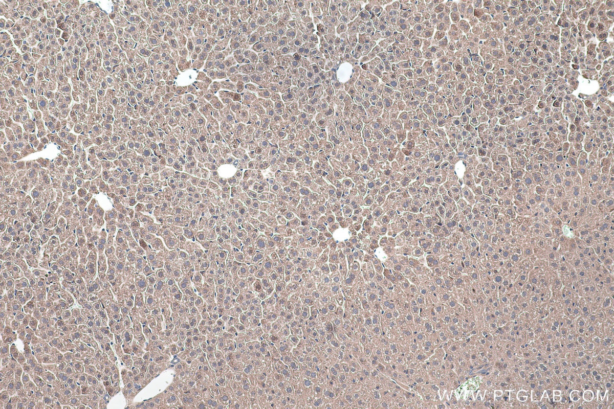 Immunohistochemical analysis of paraffin-embedded mouse liver tissue slide using KHC0455 (RSU1 IHC Kit).