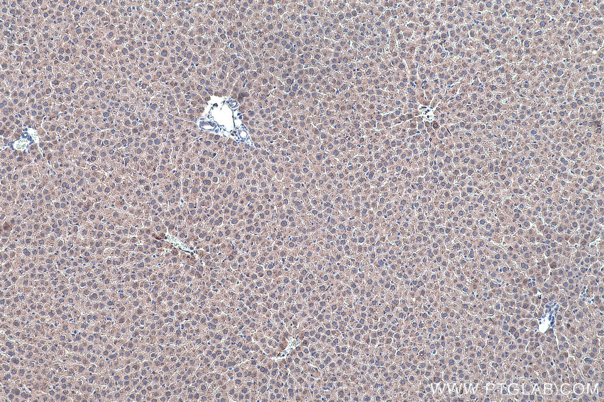 Immunohistochemical analysis of paraffin-embedded rat liver tissue slide using KHC0455 (RSU1 IHC Kit).