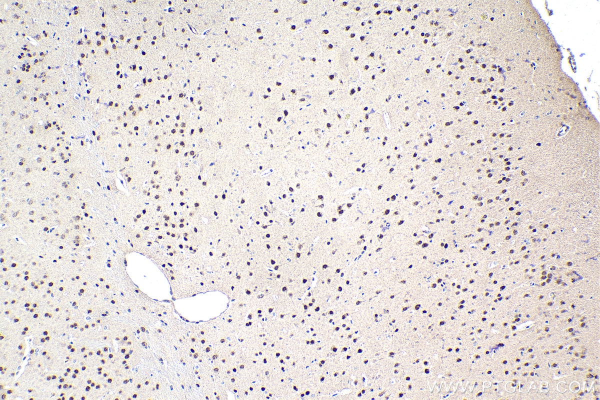 Immunohistochemical analysis of paraffin-embedded mouse brain tissue slide using KHC1681 (RUNX1T1 IHC Kit).