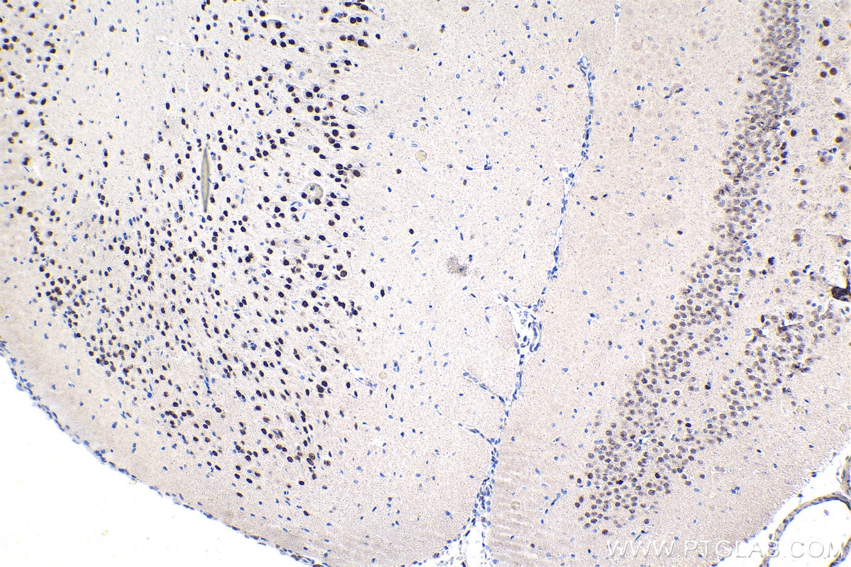 Immunohistochemical analysis of paraffin-embedded rat brain tissue slide using KHC1681 (RUNX1T1 IHC Kit).