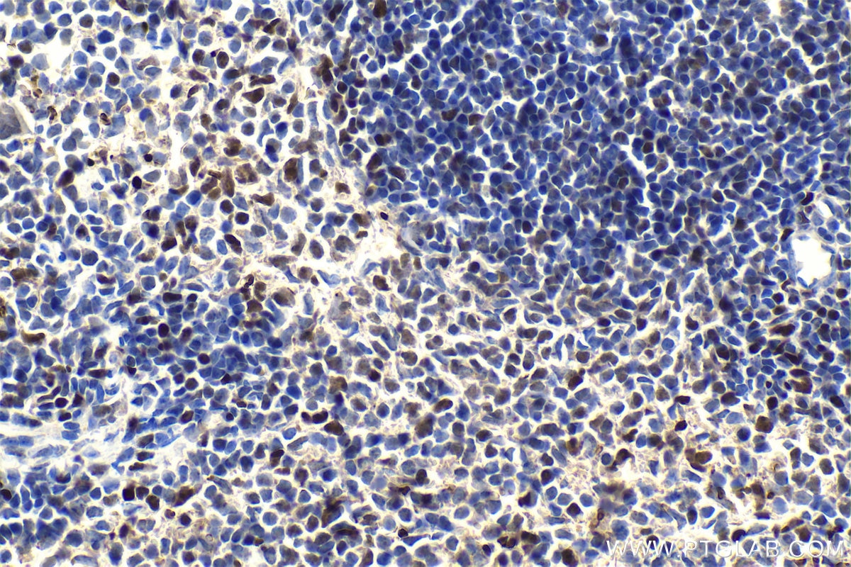 Immunohistochemical analysis of paraffin-embedded mouse spleen tissue slide using KHC1084 (RUNX3 IHC Kit).