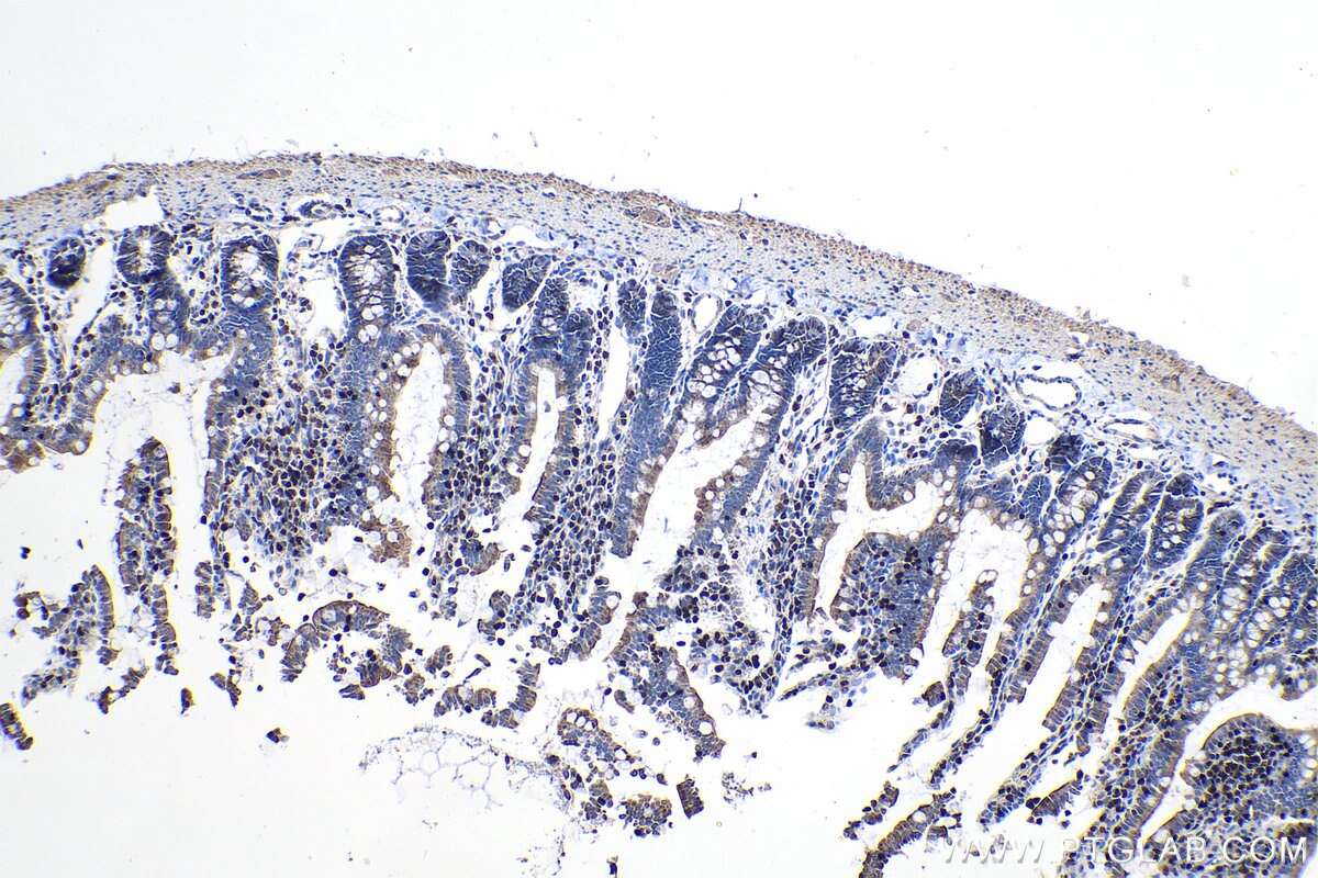 Immunohistochemical analysis of paraffin-embedded rat small intestine tissue slide using KHC1084 (RUNX3 IHC Kit).