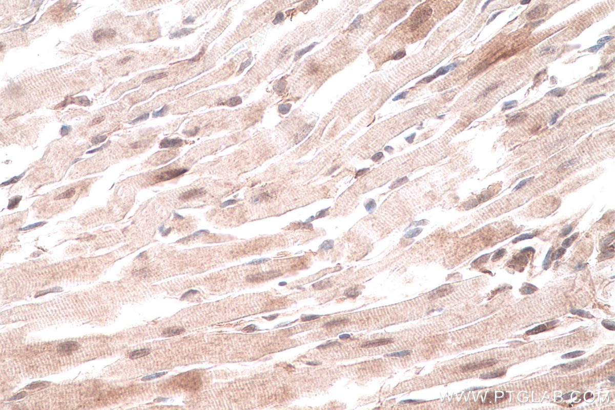 Immunohistochemical analysis of paraffin-embedded mouse heart tissue slide using KHC0828 (RUVBL1 IHC Kit).