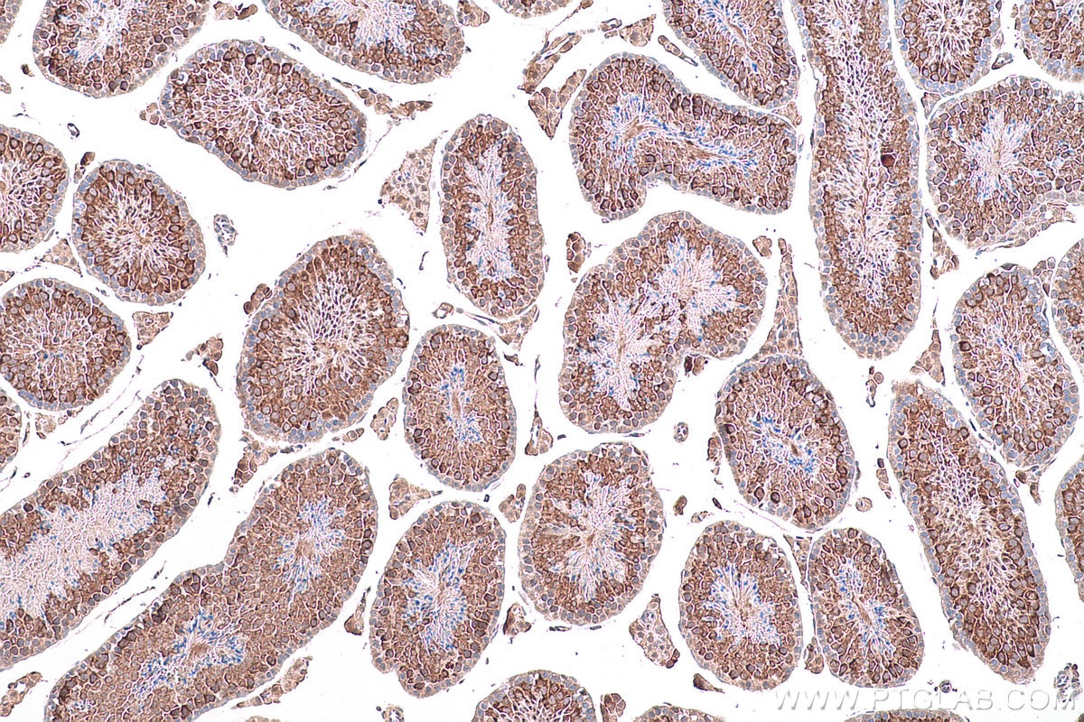 Immunohistochemical analysis of paraffin-embedded mouse testis tissue slide using KHC0828 (RUVBL1 IHC Kit).
