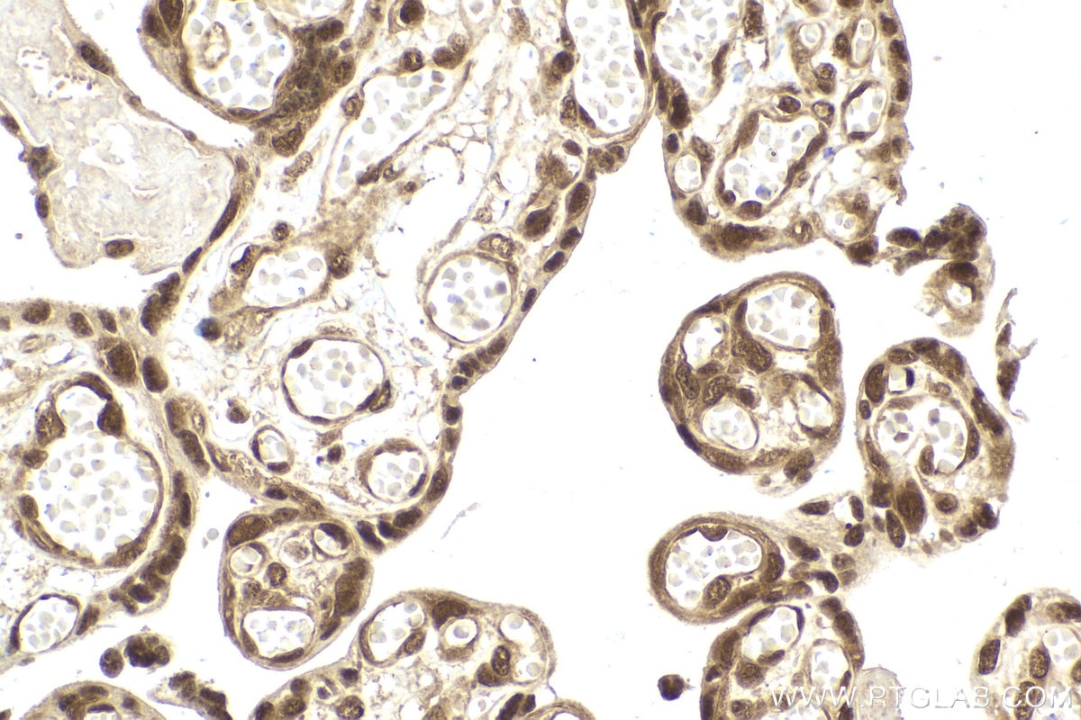 Immunohistochemical analysis of paraffin-embedded human placenta tissue slide using KHC2011 (RUVBL2 IHC Kit).