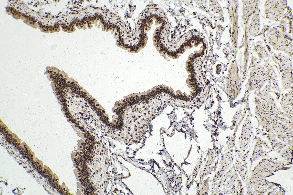 Immunohistochemical analysis of paraffin-embedded rat bladder tissue slide using KHC2011 (RUVBL2 IHC Kit).