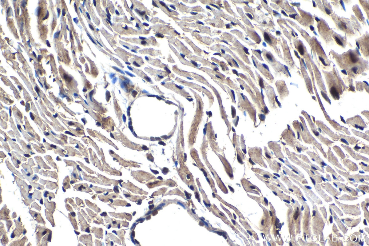 Immunohistochemical analysis of paraffin-embedded mouse heart tissue slide using KHC1603 (RXRA IHC Kit).