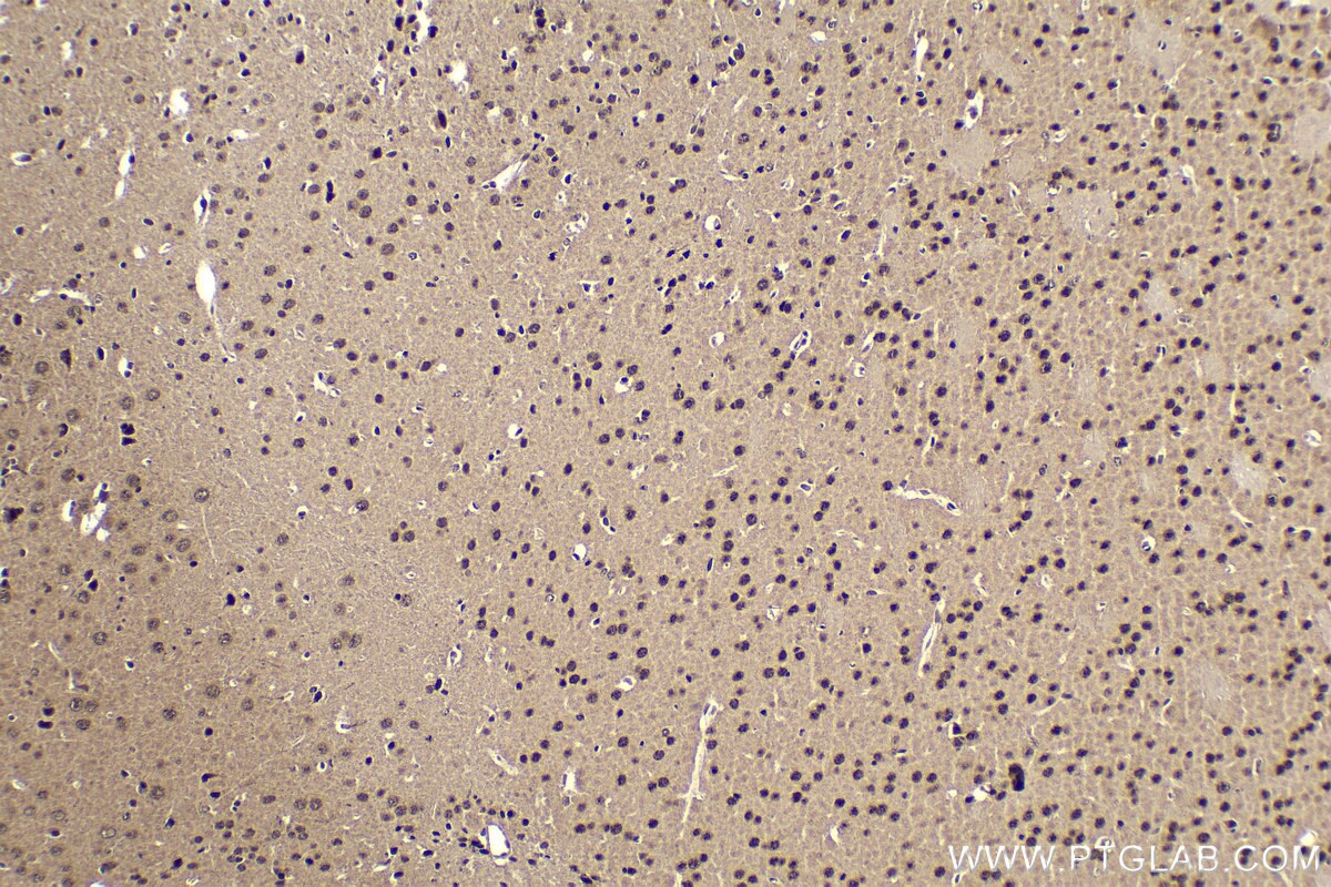 Immunohistochemical analysis of paraffin-embedded mouse brain tissue slide using KHC1575 (RXRB IHC Kit).
