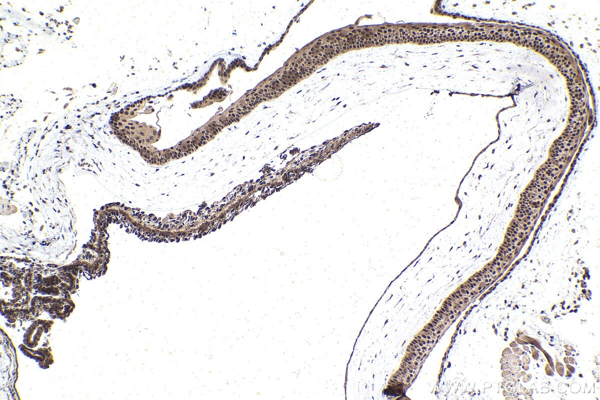 Immunohistochemical analysis of paraffin-embedded mouse eye tissue slide using KHC1611 (RXRG IHC Kit).