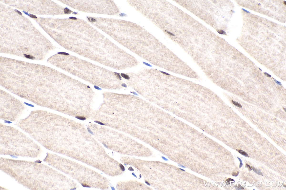 Immunohistochemical analysis of paraffin-embedded mouse skeletal muscle tissue slide using KHC1611 (RXRG IHC Kit).