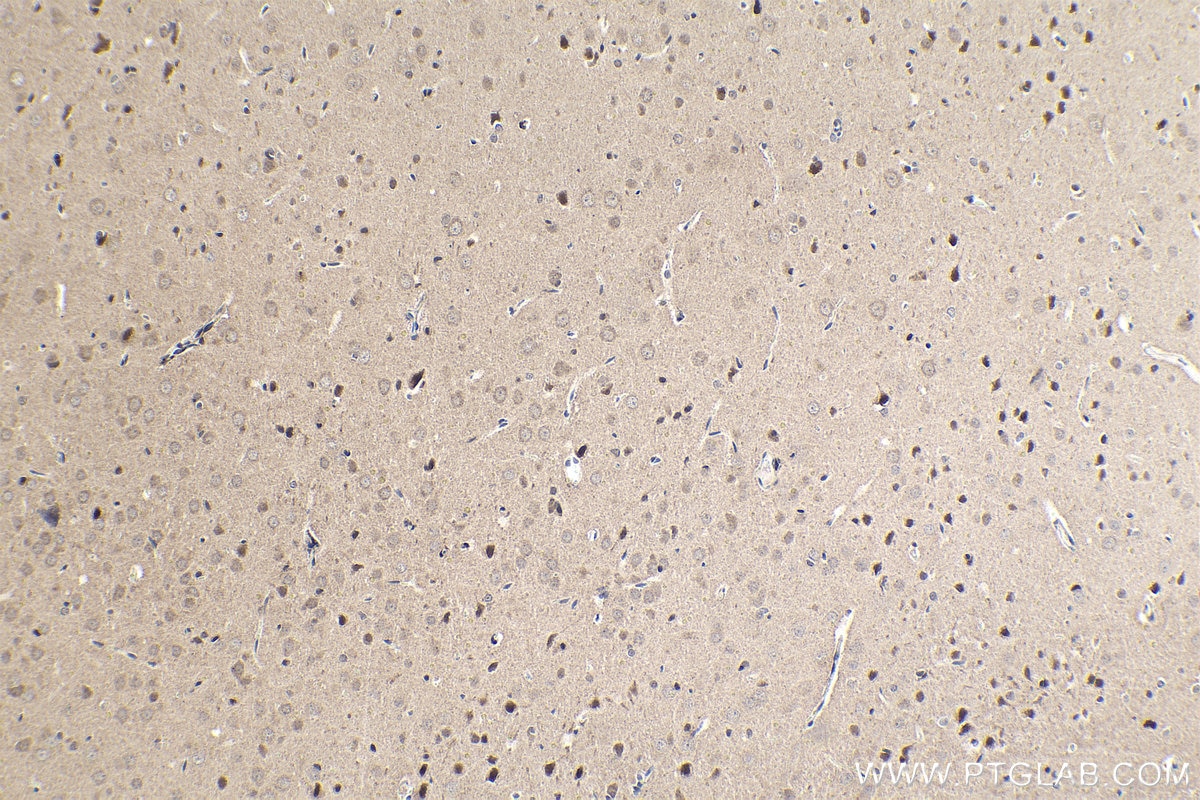 Immunohistochemical analysis of paraffin-embedded rat brain tissue slide using KHC1611 (RXRG IHC Kit).