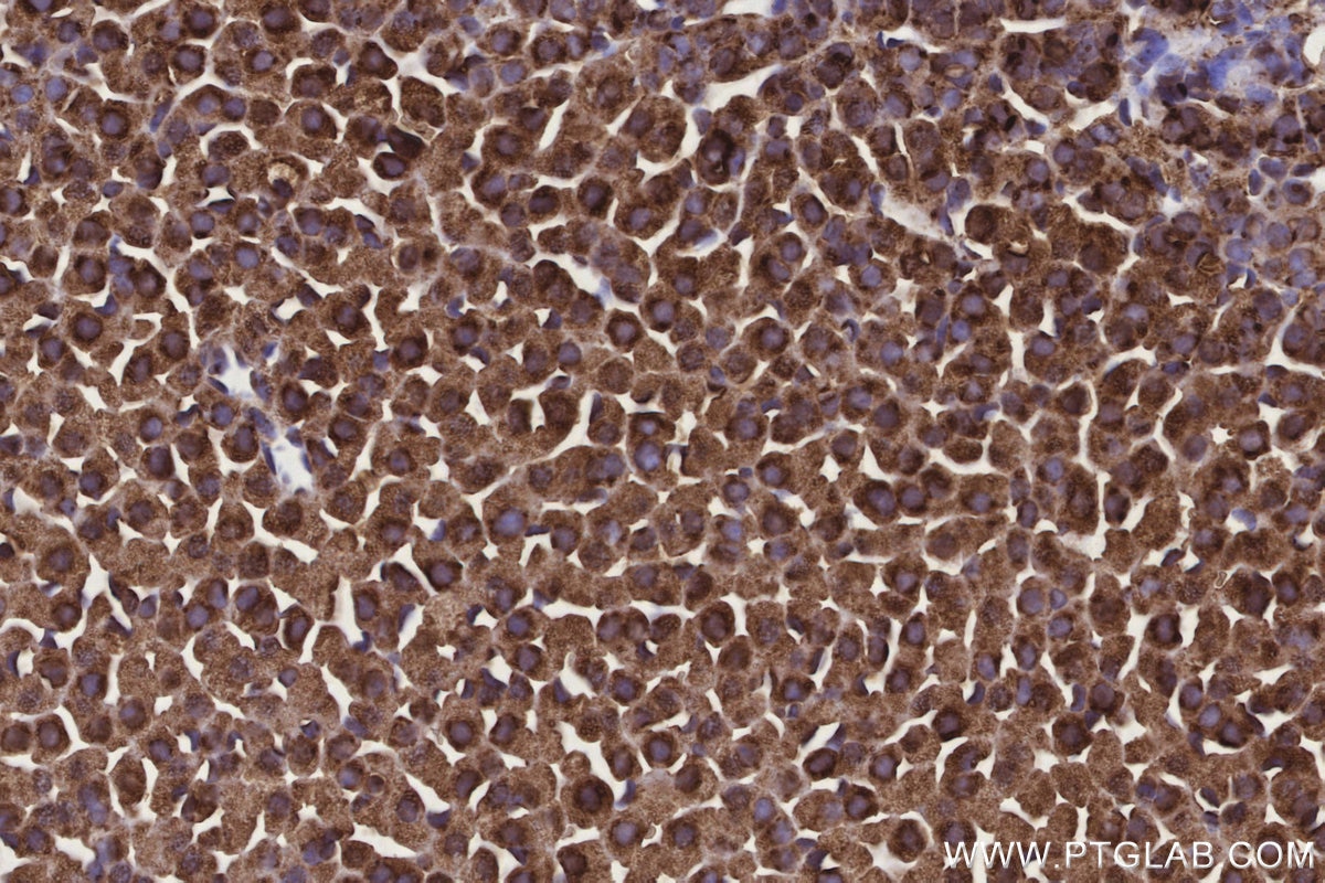 Immunohistochemical analysis of paraffin-embedded mouse adrenal gland tissue slide using KHC3169 (Ribophorin I IHC Kit).